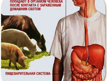 БРУЦЕЛЛЕЗ